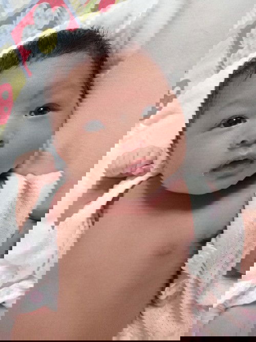 คลอดแล้วค่ะ น้องเป็นท่อน้ำตาอุดตัน