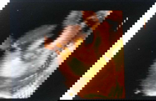 ลูกสาว34วีคแล้ว