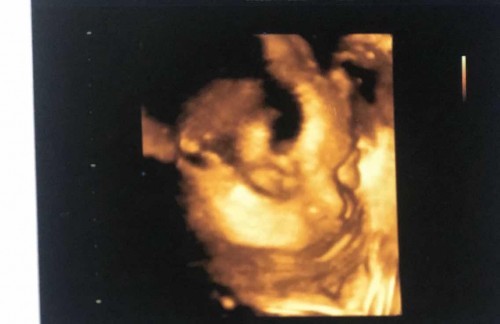 ลูกสาว34วีคแล้ว