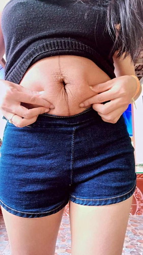 ฉันรักพุงหลังคลอด