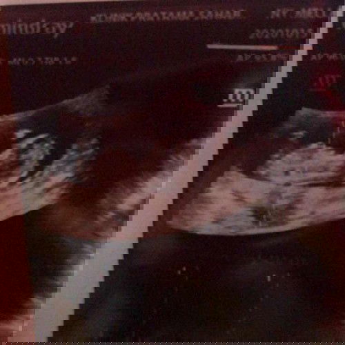 Harus ngikutin dokter ?