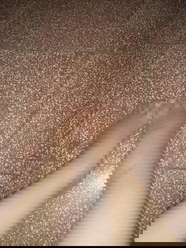 32 week kaki bengkak