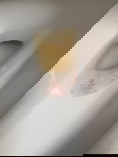 เลือดออก 37+3