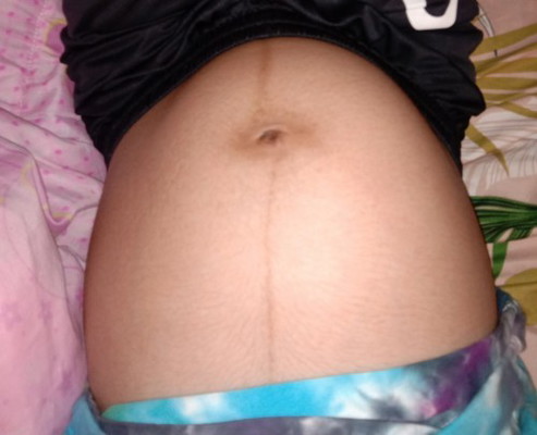 38+1วีค กำหนดคลอดพฤศจิกายน