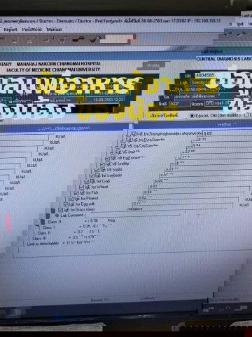 ขอถามผู้รู้เรื่องแพ้อาหารค่ะ