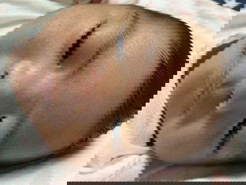 สอบถามค่ะ น้องเป็นผื่นอะไร