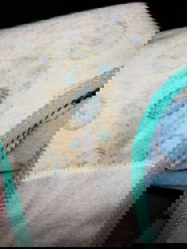 WHITE DISCHARGE