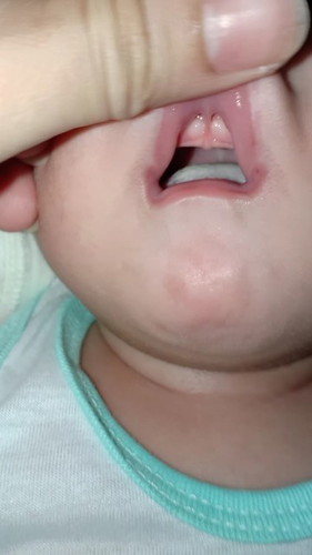 Possible Teething??