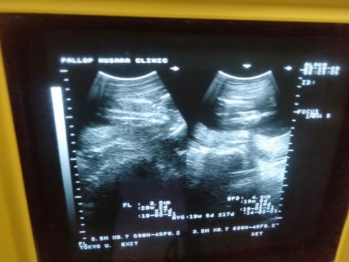 ผู้หญิงรึผู้ชาย