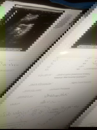 Bunda bunda ada yg sama ngga, soalnya saya baru pertama kali hamil pertama..