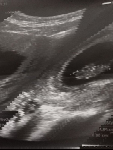 ขอคำแนะนำจากคุณแม่หน่อยคะ🙏