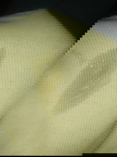 Mucus Plug?