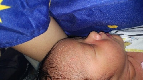 semenjak ganti sabun jdi bruntusan gini, ini apa ya dan gimana cara ngilanginnya?