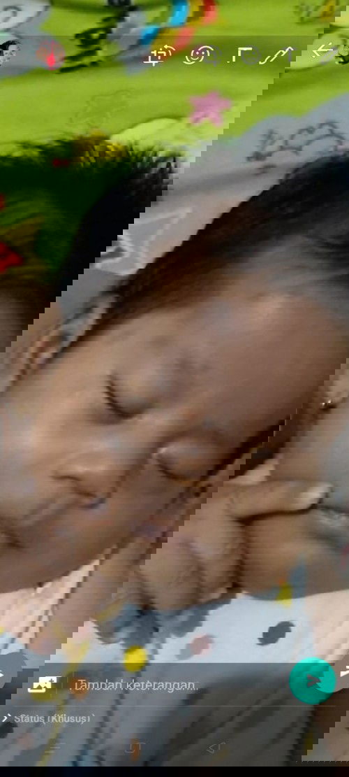 bekas gigitan nyamuk