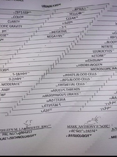Urinalysis result