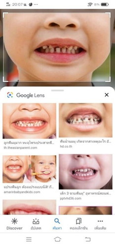 ถ้าปล่อยไว้น้องจะปวดมั้ย
