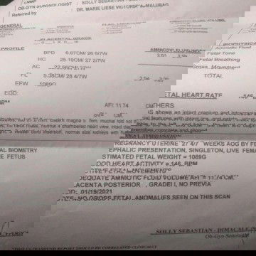 hello po.. pahelp naman po mga mommies😊 next week pa balik ko sa ob ko, nagpa CAS po kasi ako..