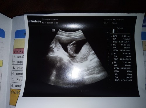 แบบนี้ผญหรือผชค่ะ