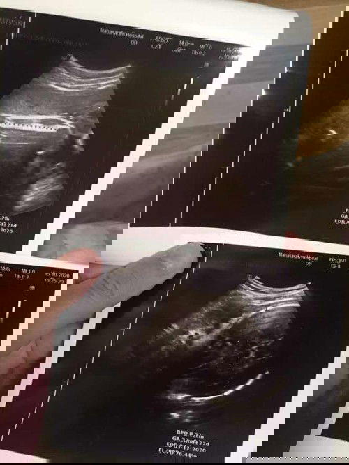 แม่ๆคนไหนดูออกบ้างคะ
รูป2เราดูไม่ออก ช่วยดูไห้หน่อยค่ะ