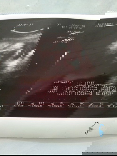 แม่ๆทีมธันวามาอวดใบชาวห์กันค่ะว่าไปถึงไหนกันแล้วนนลูกเท่าไหร่กันบ้างค่ะ