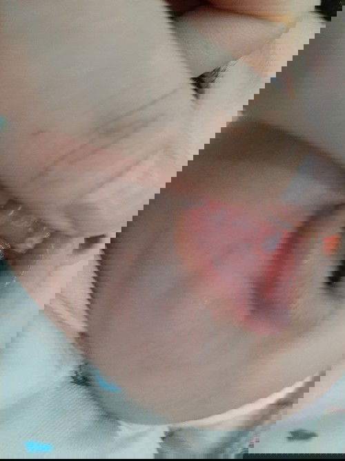 Baby 4m cho hỏi bé bị sao