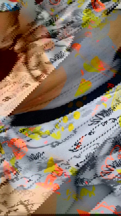 Bintik merah pada muka bayi baru lahir