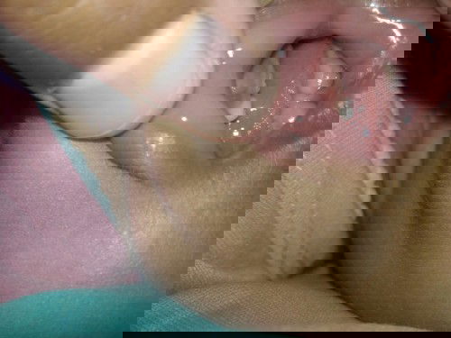 Tumbuh gigi atau sariawan ?