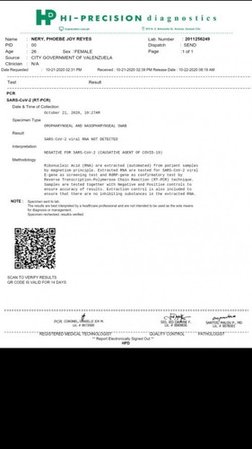 Thanks God Negative sa Swab test. konting kembot na lang lalabas na si baby Boy👼🤰