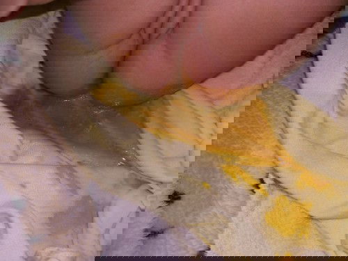 Con đi ngoài phân k đẹp