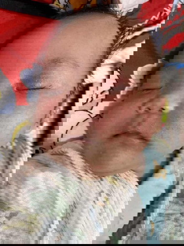 หน้าลูกเป็นผื่นหาหมอยังไงก็ไม่หายมีวิธีมาบอกแม่บ้านทั้งหลายคะ