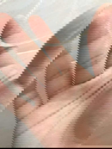 เลือดออกซึม15w