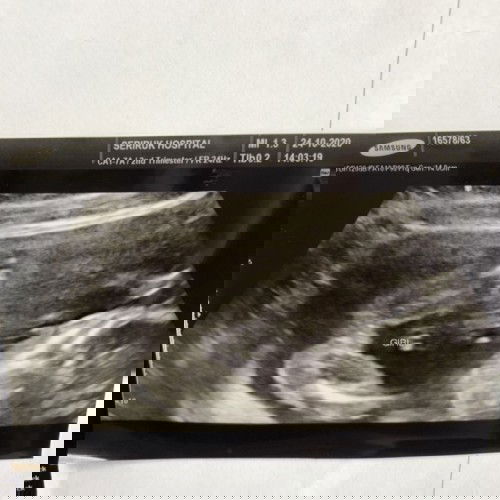 กำหนดคลอด 11 มีนาคม 2564