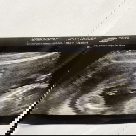 กำหนดคลอด 11 มีนาคม 2564