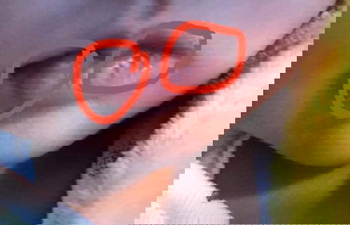 ปากลูกดำแบบนี้เป็นอะไรไหมคะ