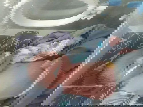 24jam induksi akhirnya sesar juga