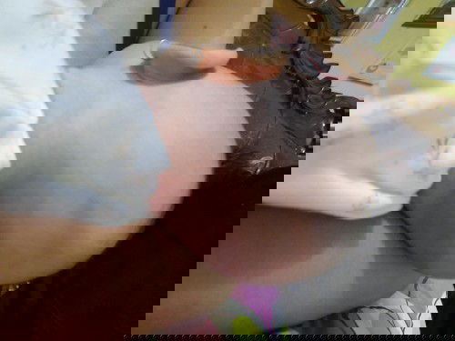 Fontanel posterior (titik lunak kepala belakang)