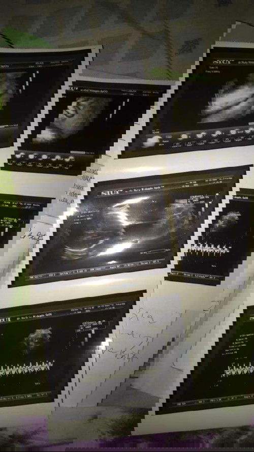 Alhamdulilah bayiku sehat