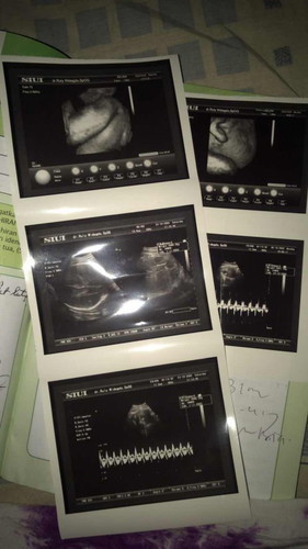 Alhamdulilah bayiku sehat