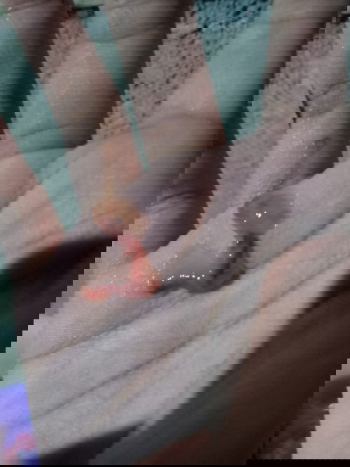 ขอสอบถามหน่อยค่ะ แบบนี้ใช่มูกเลือดมั้ย