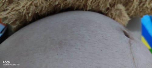 Rashes natural remedies