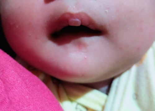 Seputar bayi