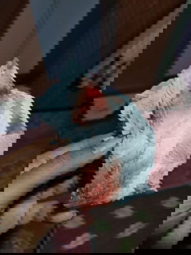 สอบถามค่ะสีเลือดแบบนี้ควรไปรพ.ได้หรือยังคะ