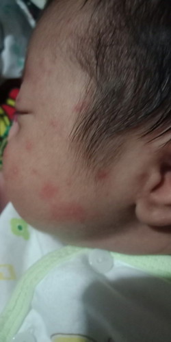 ใช้อะไรถึงหายค่ะ