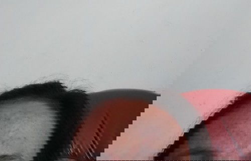 Saya hmil ke2 usia kandungan 21weeks wajah saya koq jerawatan kira² bawahan bayi/tdk ada yg sma gak?