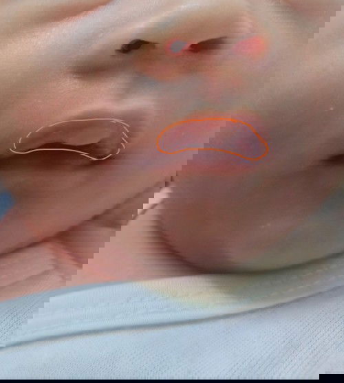 Ano po kaya ito? Dapat ba ito ikabahala?