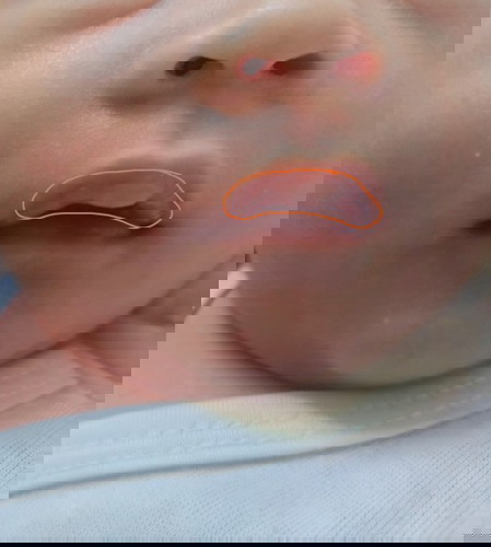 Ano po kaya ito? Dapat ba ito ikabahala?