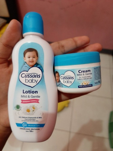 Bayi beruntusan
