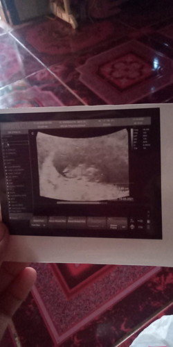 Usia kndungn mau jalan 12 minggu ..tp sring kelelahan ,mual muntah trus ...g mau makan nasi.........