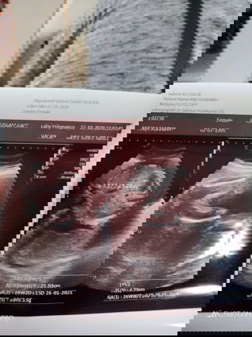 Berat badan janin lebih