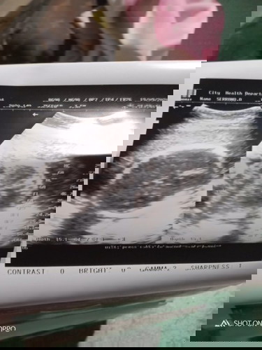 Nag pa uts po ako 26 weeks now 31 weeks na po ako